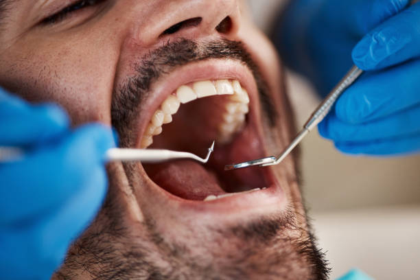 Best Emergency Treatment for Dental Infections or Abscesses in Ruidoso, NM